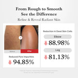 Medicube - Hypochlorous Acid Body Peel Shot 280ml