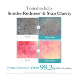 Medicube - Azelaic Acid Deep Clean Foam Cleanser 120ml