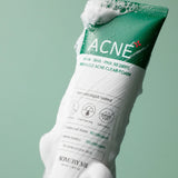 Some By Mi - AHA, BHA, PHA 30 Days Miracle Acne Clear Foam 100ml