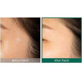 Some By Mi - 30 Days Miracle Clear Spot Patch 18pcs